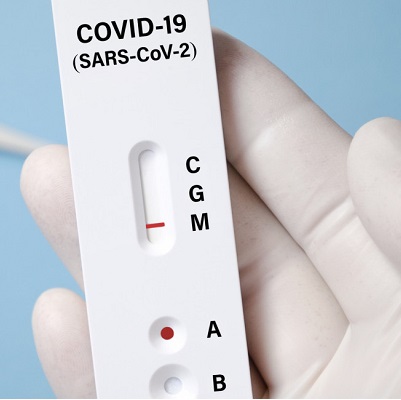 2019-nCoV Antigen Test 2019-nCoV Antigen Test
